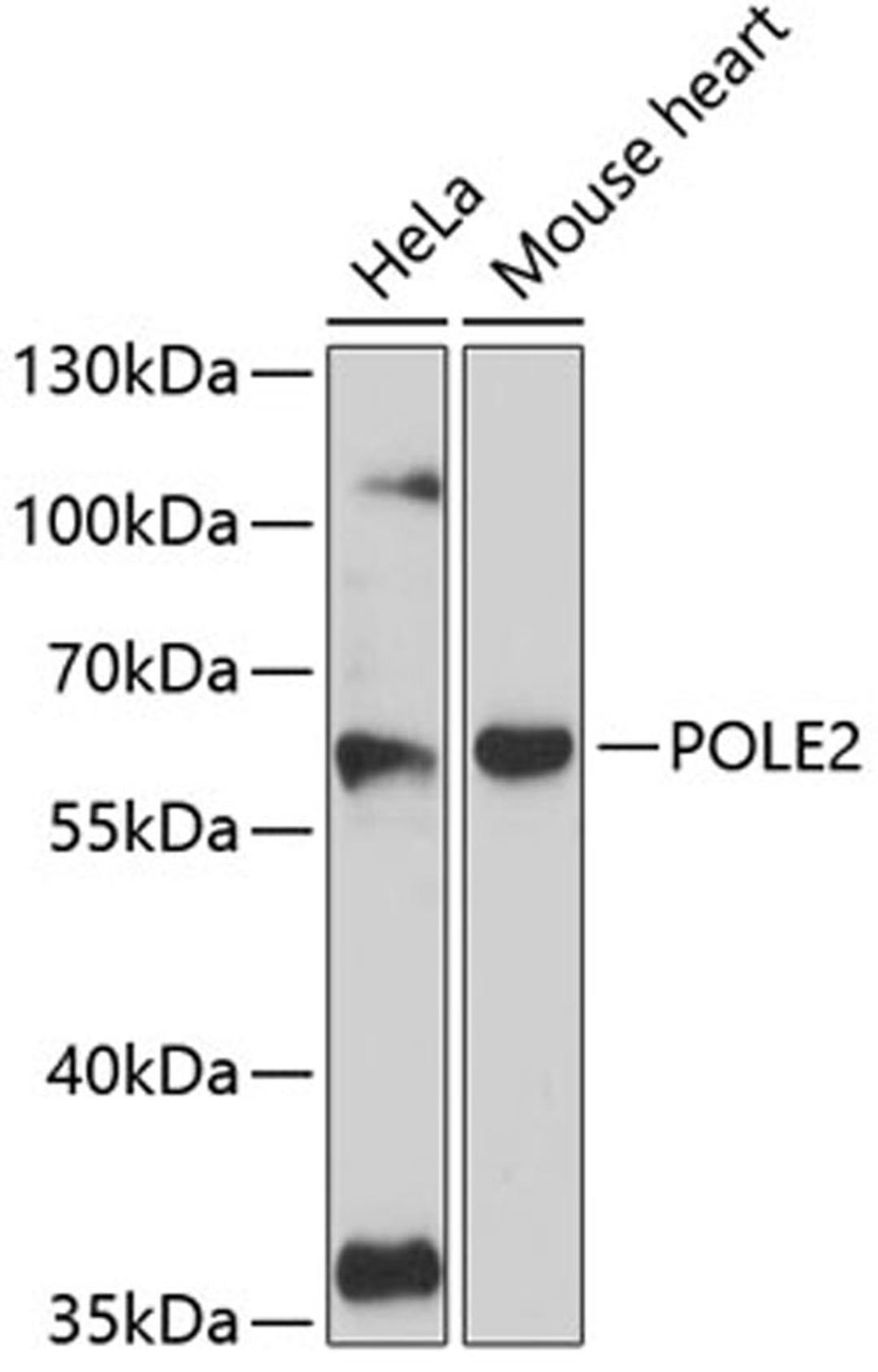 Western blot - POLE2 antibody (A12842)