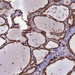 Immunohistochemistry-Paraffin: CYP2R1 Antibody [NBP2-13895] - Staining of human thyroid gland shows strong cytoplasmic and nuclear positivity in glandular cells.