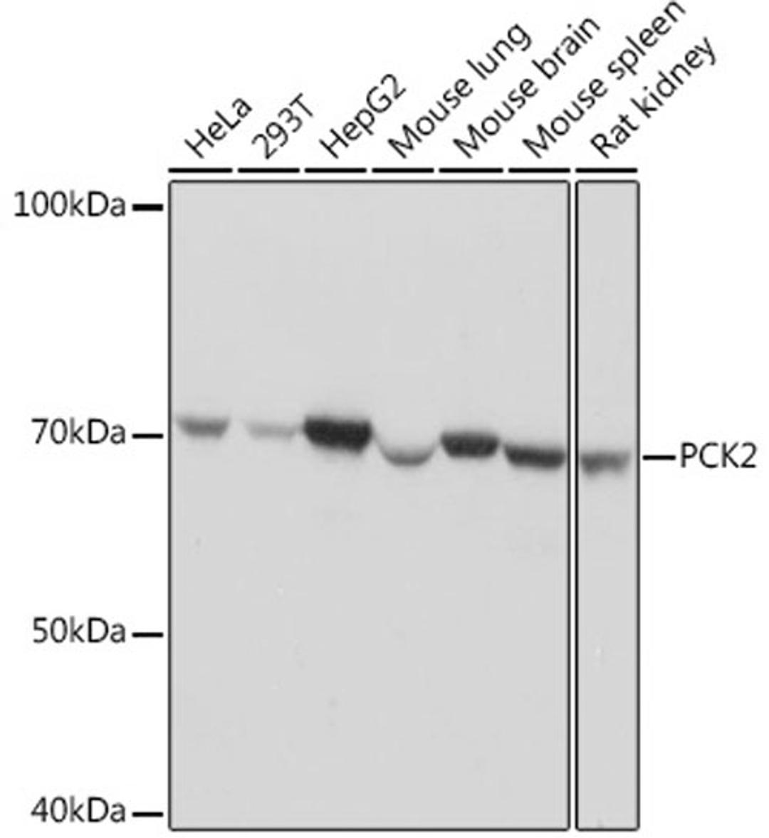 Western blot - PCK2 Rabbit mAb (A4466)