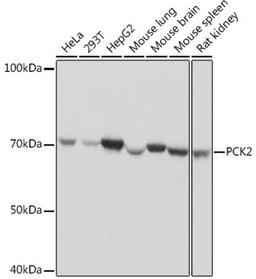 Western blot - PCK2 Rabbit mAb (A4466)