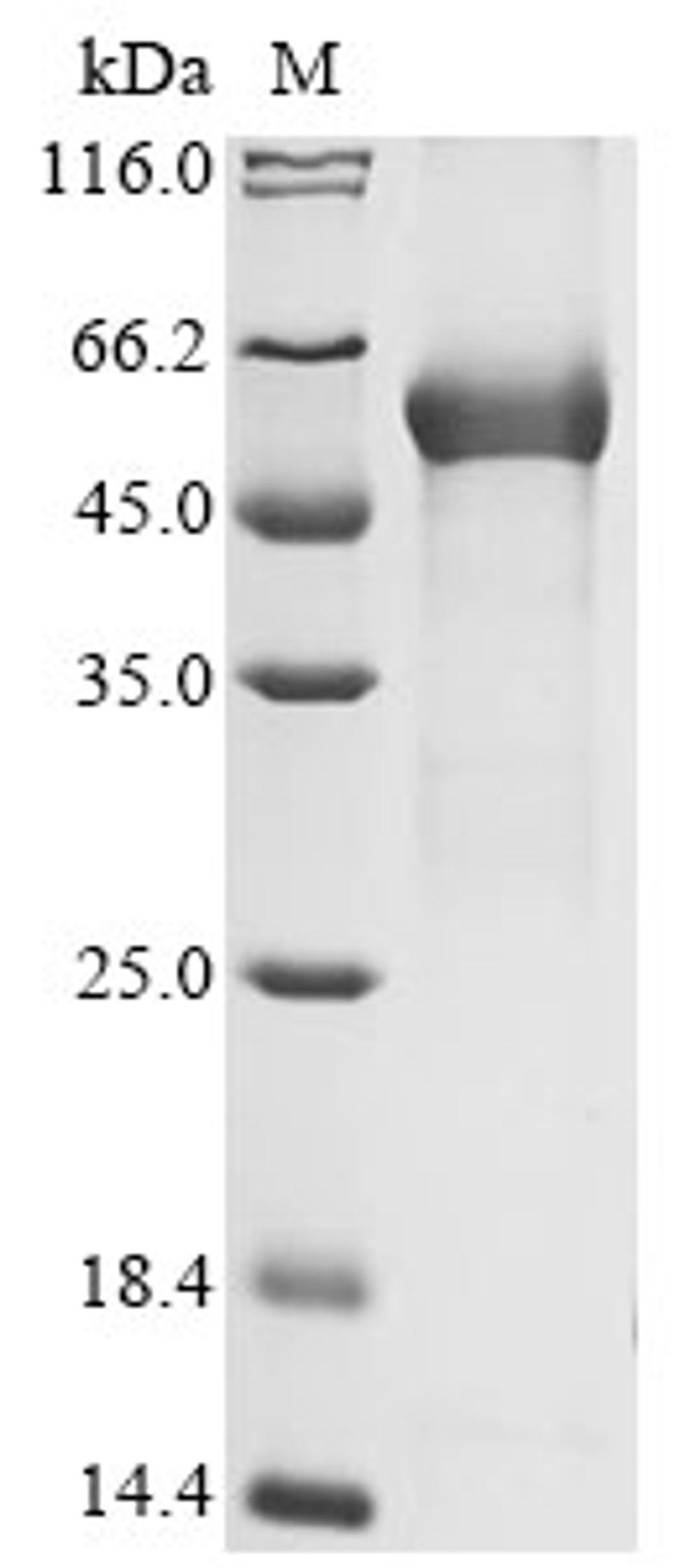 (Tris-Glycine gel) Discontinuous SDS-PAGE (reduced) with 5% enrichment gel and 15% separation gel.