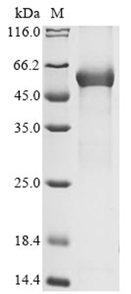 (Tris-Glycine gel) Discontinuous SDS-PAGE (reduced) with 5% enrichment gel and 15% separation gel.