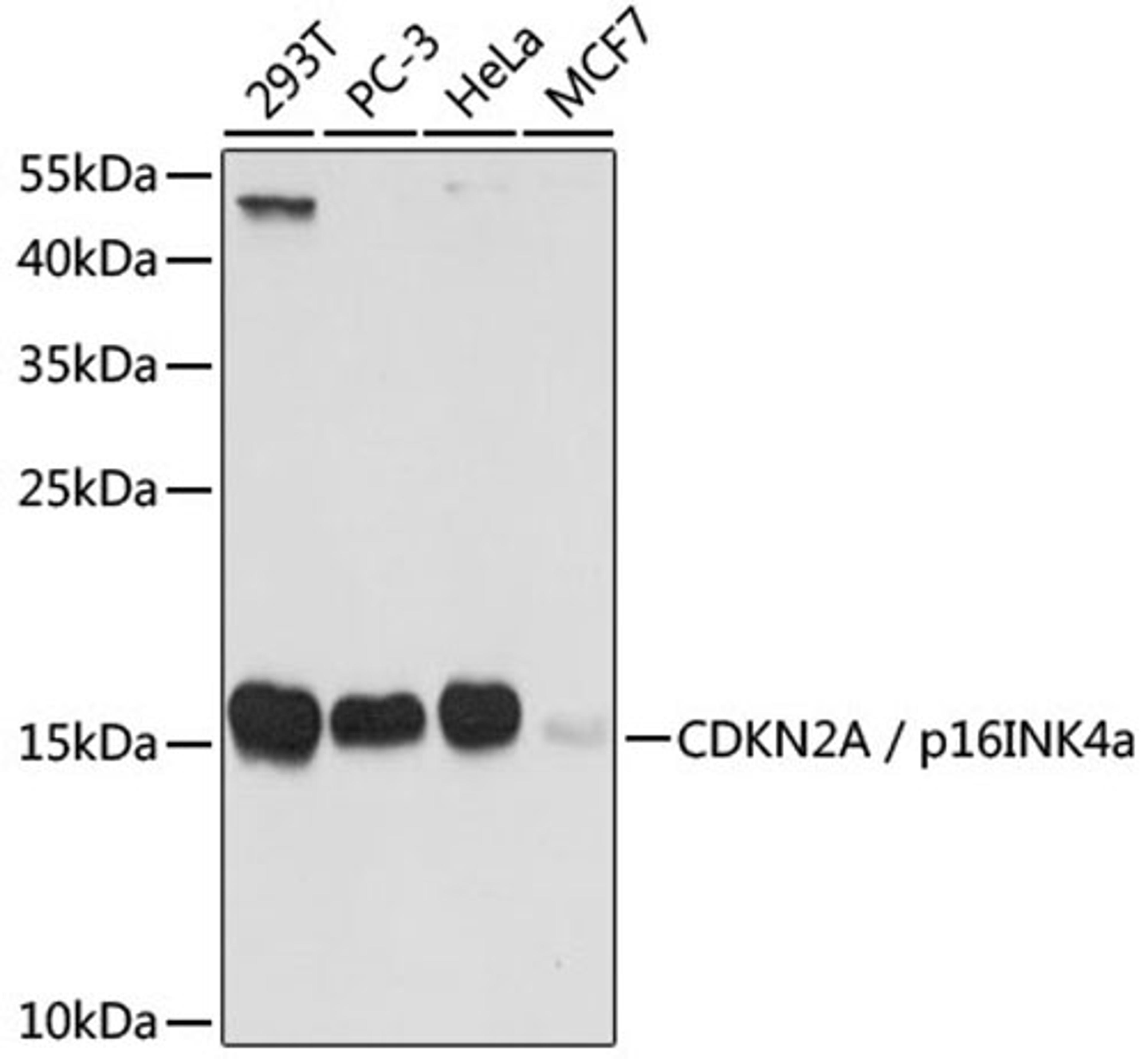 Western blot - CDKN2A / p16INK4a antibody (A0262)