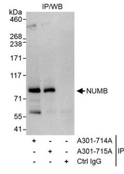 Detection of human NUMB by western blot of immunoprecipitates.