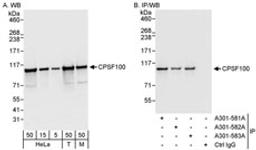 Detection of human and mouse CPSF100 by western blot (h&m) and immunoprecipitation (h).