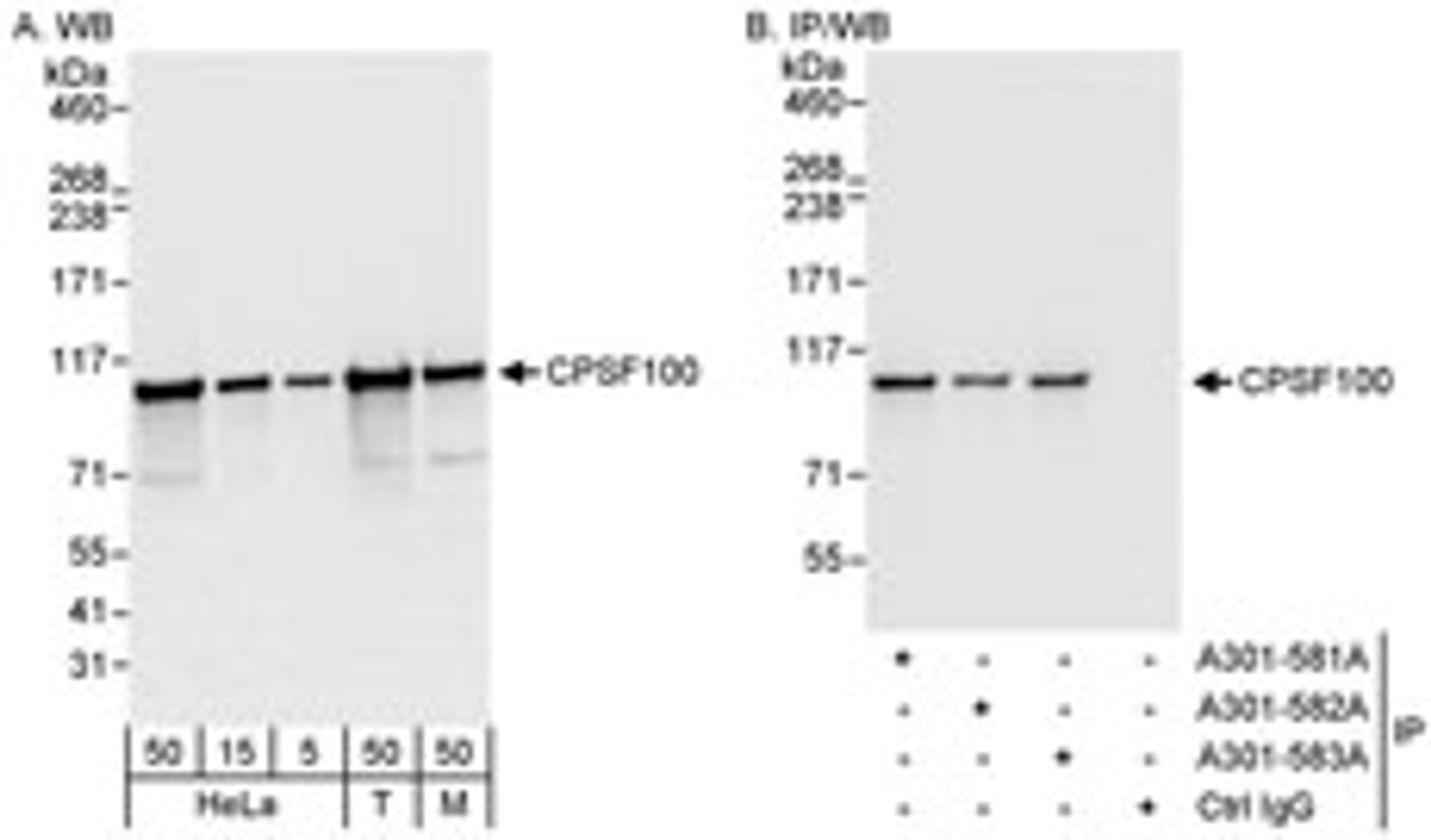 Detection of human and mouse CPSF100 by western blot (h&m) and immunoprecipitation (h).