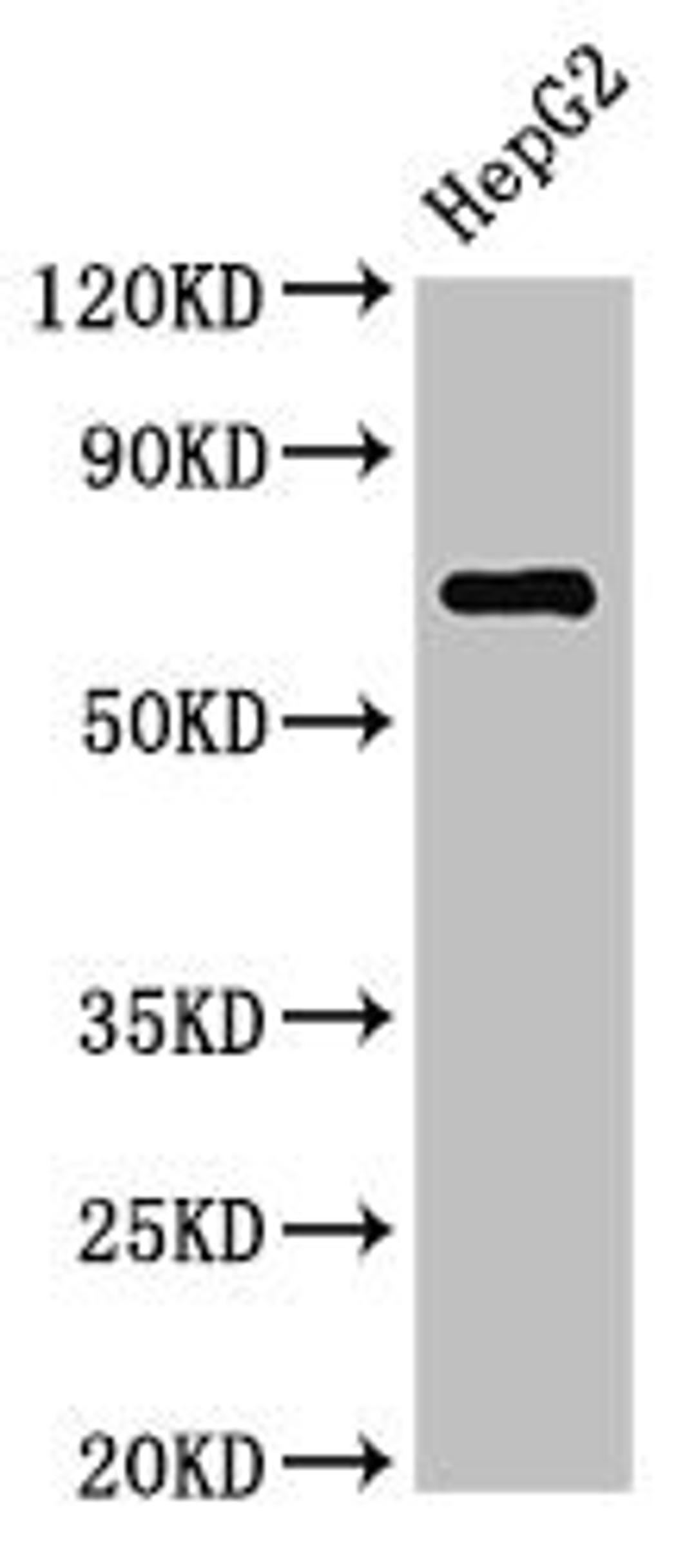 Western Blot. Positive WB detected in: HepG2 whole cell lysate. All lanes: ST6GALNAC1 antibody at 2.7ug/ml. Secondary. Goat polyclonal to rabbit IgG at 1/50000 dilution. Predicted band size: 69 kDa. Observed band size: 69 kDa. 