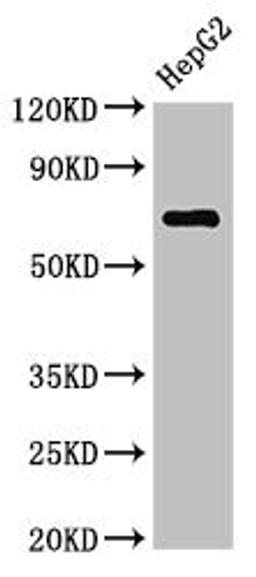 Western Blot. Positive WB detected in: HepG2 whole cell lysate. All lanes: ST6GALNAC1 antibody at 2.7ug/ml. Secondary. Goat polyclonal to rabbit IgG at 1/50000 dilution. Predicted band size: 69 kDa. Observed band size: 69 kDa. 