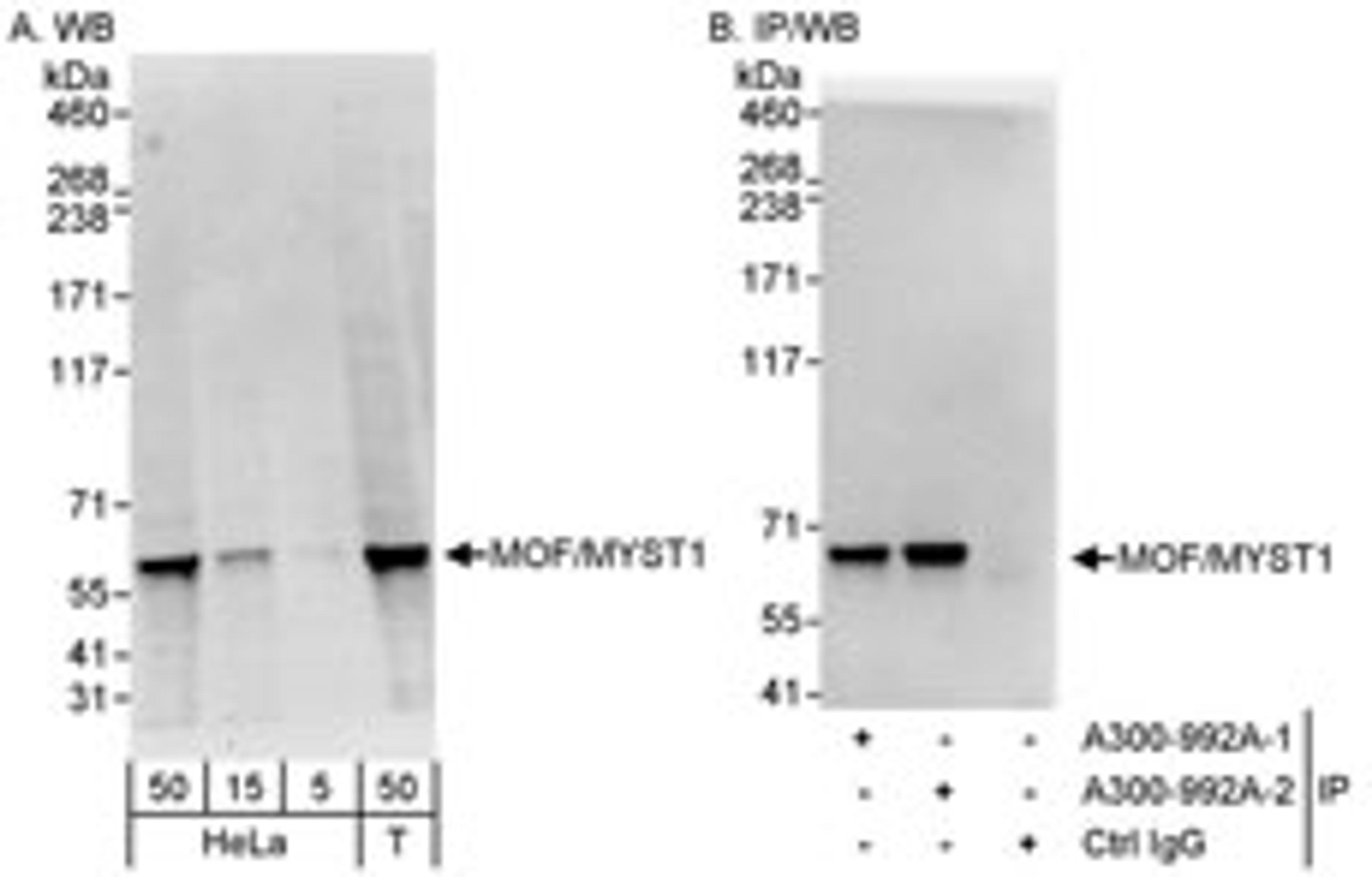 Detection of human MOF/MYST1 by western blot and immunoprecipitation.