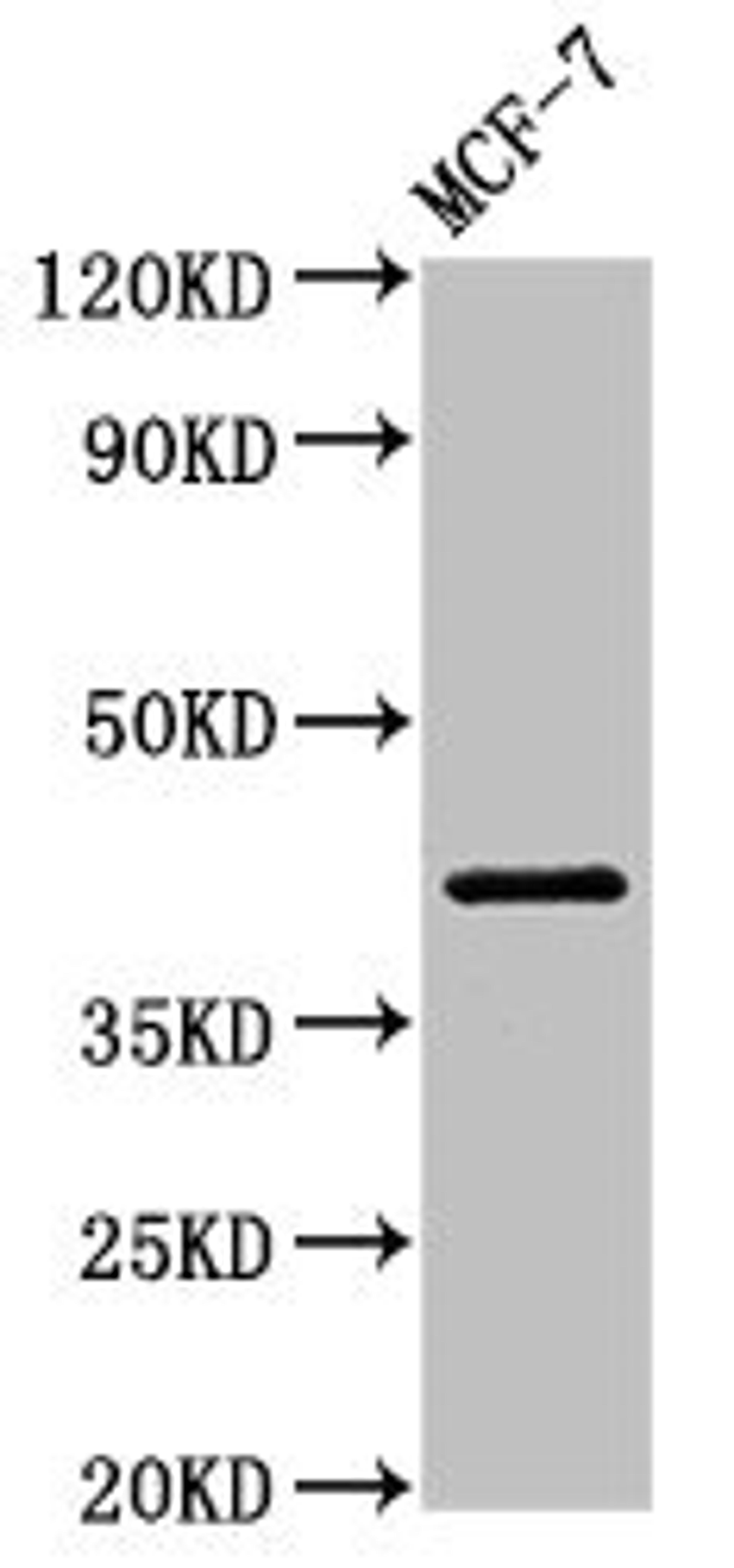 Western Blot. Positive WB detected in: MCF-7 whole cell lysate. All lanes: ACTR1A antibody at 1µg/ml. Secondary. Goat polyclonal to rabbit IgG at 1/50000 dilution. Predicted band size: 43 kDa. Observed band size: 43 kDa