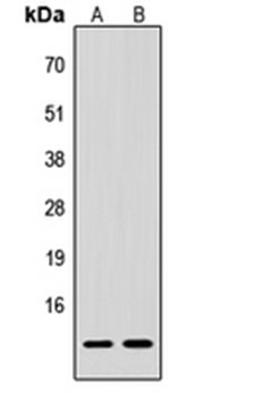 Western blot analysis of HeLa (Lane 1), H9C2 (Lane 2) whole cell lysates using Alpha-type CGRP antibody