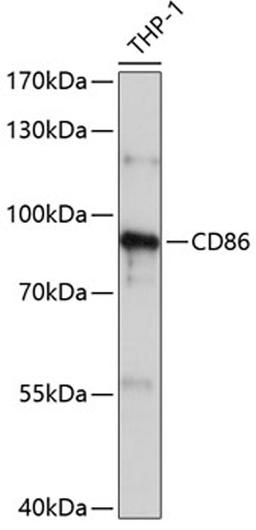 Western blot - CD86 Antibody (A1199)