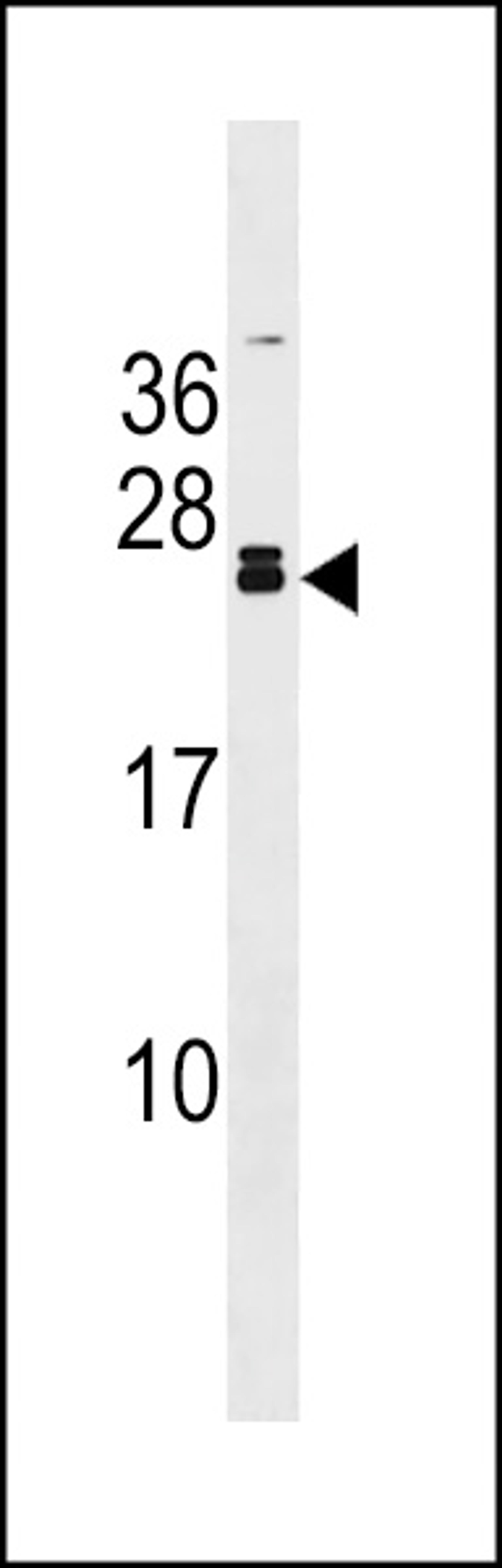 Western blot analysis in mouse kidney tissue lysates (35ug/lane).