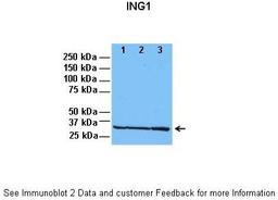 Antibody used in WB on Human cell lines at: 1:1000 (Lane 1: 30ug HeLa lysate, Lane 2: 30ug HFF lysate, Lane 3: 30ug U2OS lysate).