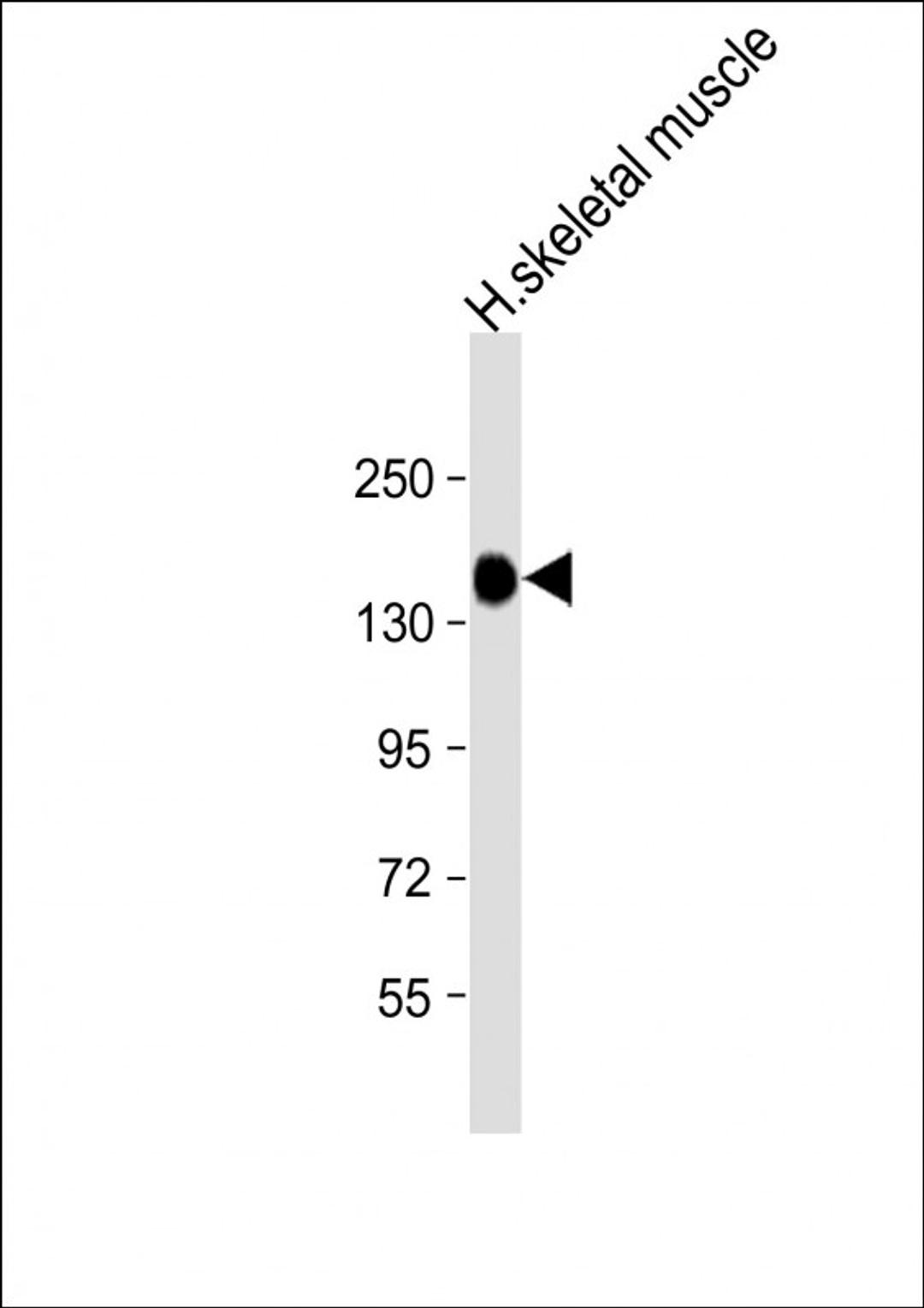 Western Blot at 1:8000 dilution + human skeletal muscle lysate Lysates/proteins at 20 ug per lane.