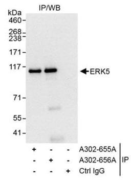 Detection of human ERK5 by western blot of immunoprecipitates.