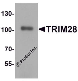 Western blot analysis of TRIM28 in human testis tissue lysate with TRIM28 antibody at 1 μg/mL.