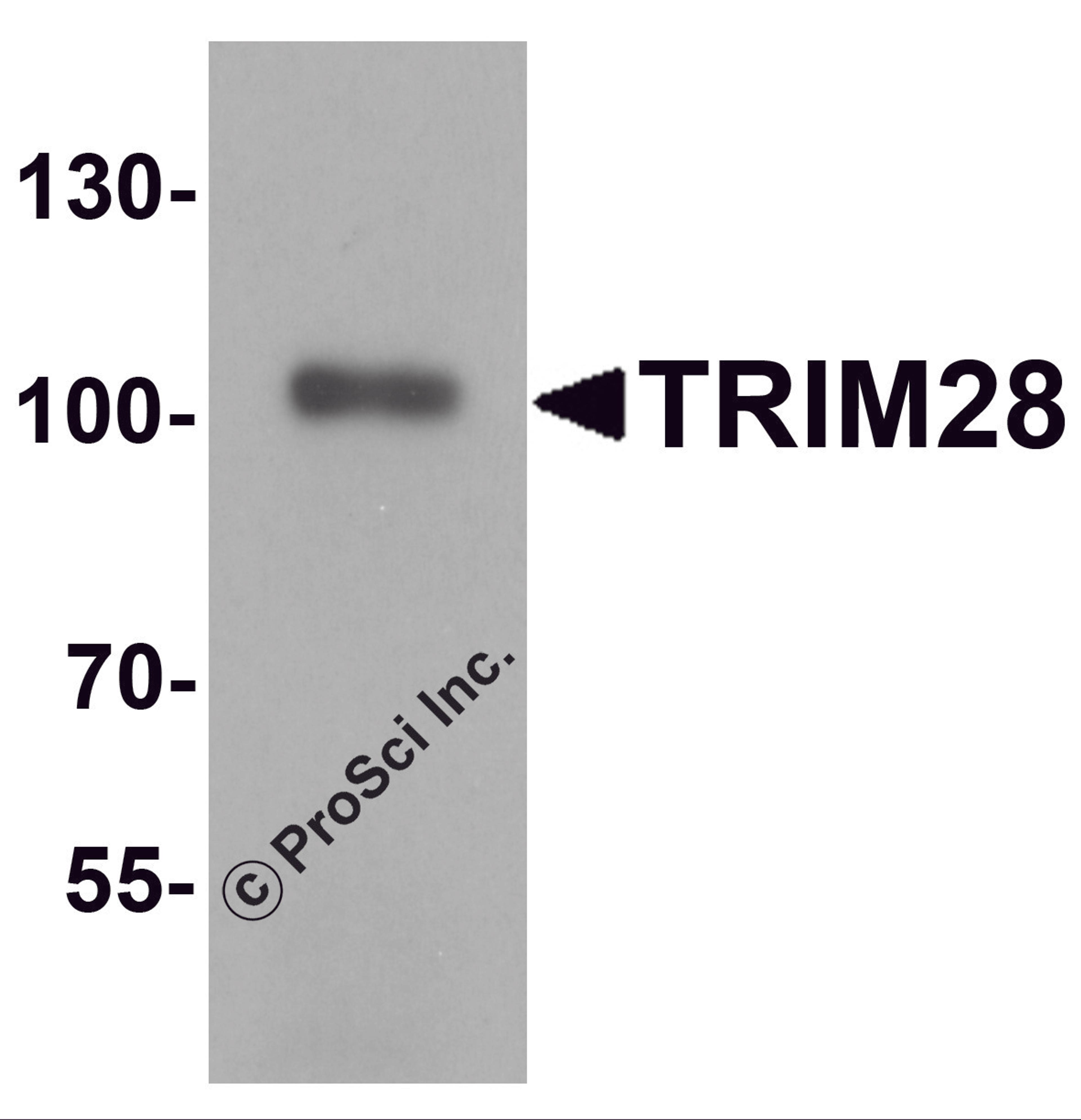 Western blot analysis of TRIM28 in human testis tissue lysate with TRIM28 antibody at 1 μg/mL.