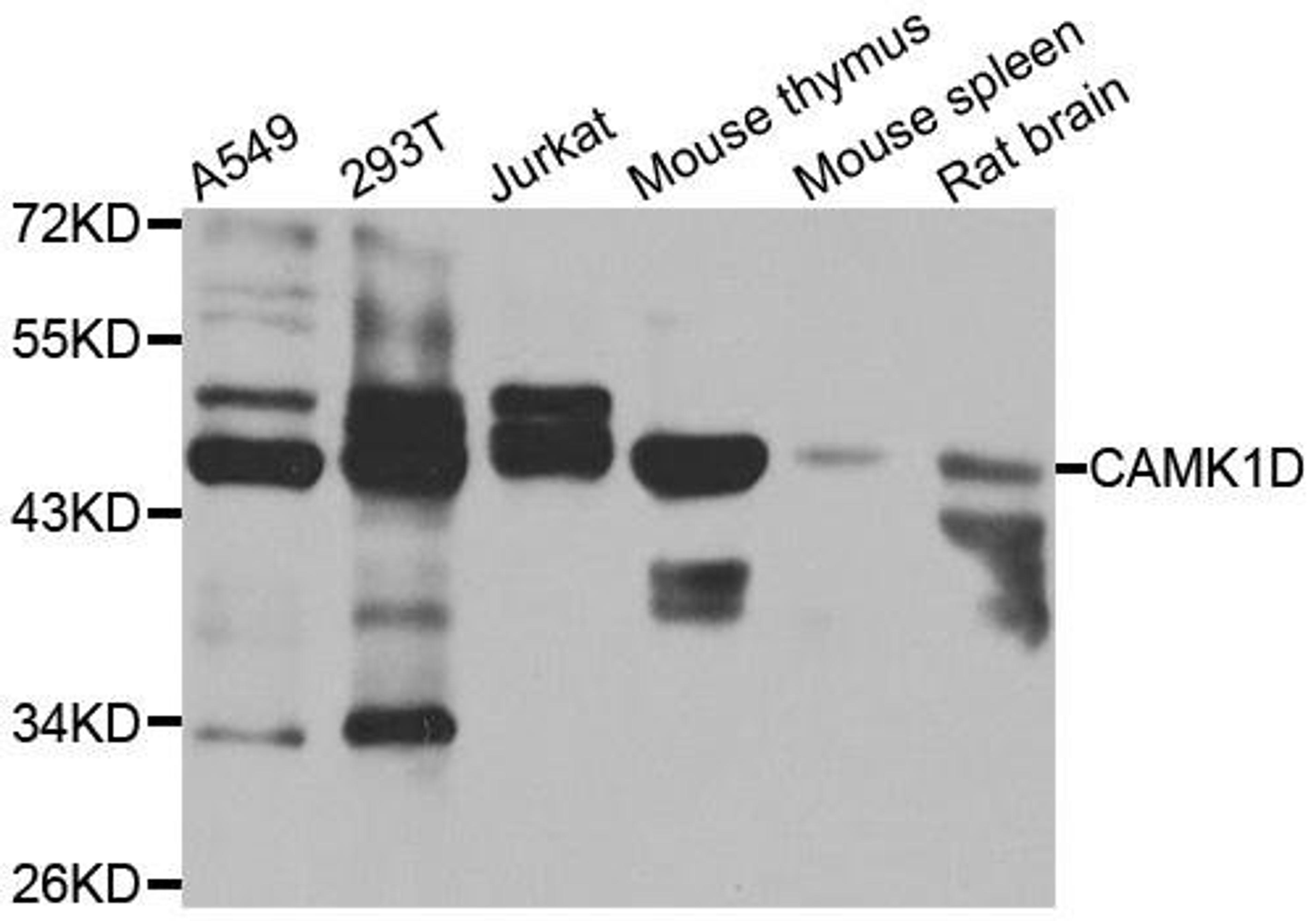 Western blot analysis of extracts of various cell lines using CAMK1D antibody