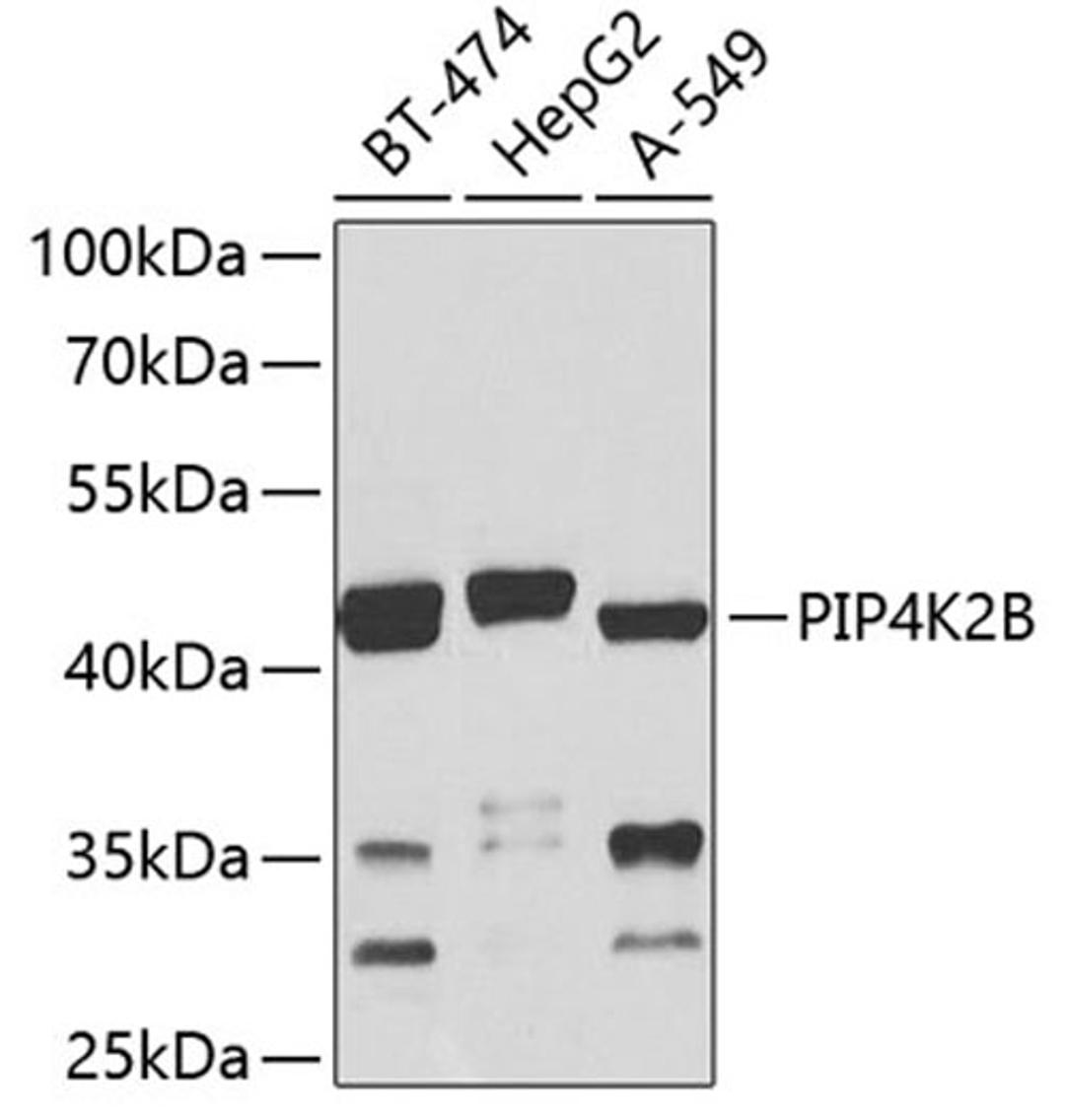 Western blot - PIP4K2B antibody (A8016)