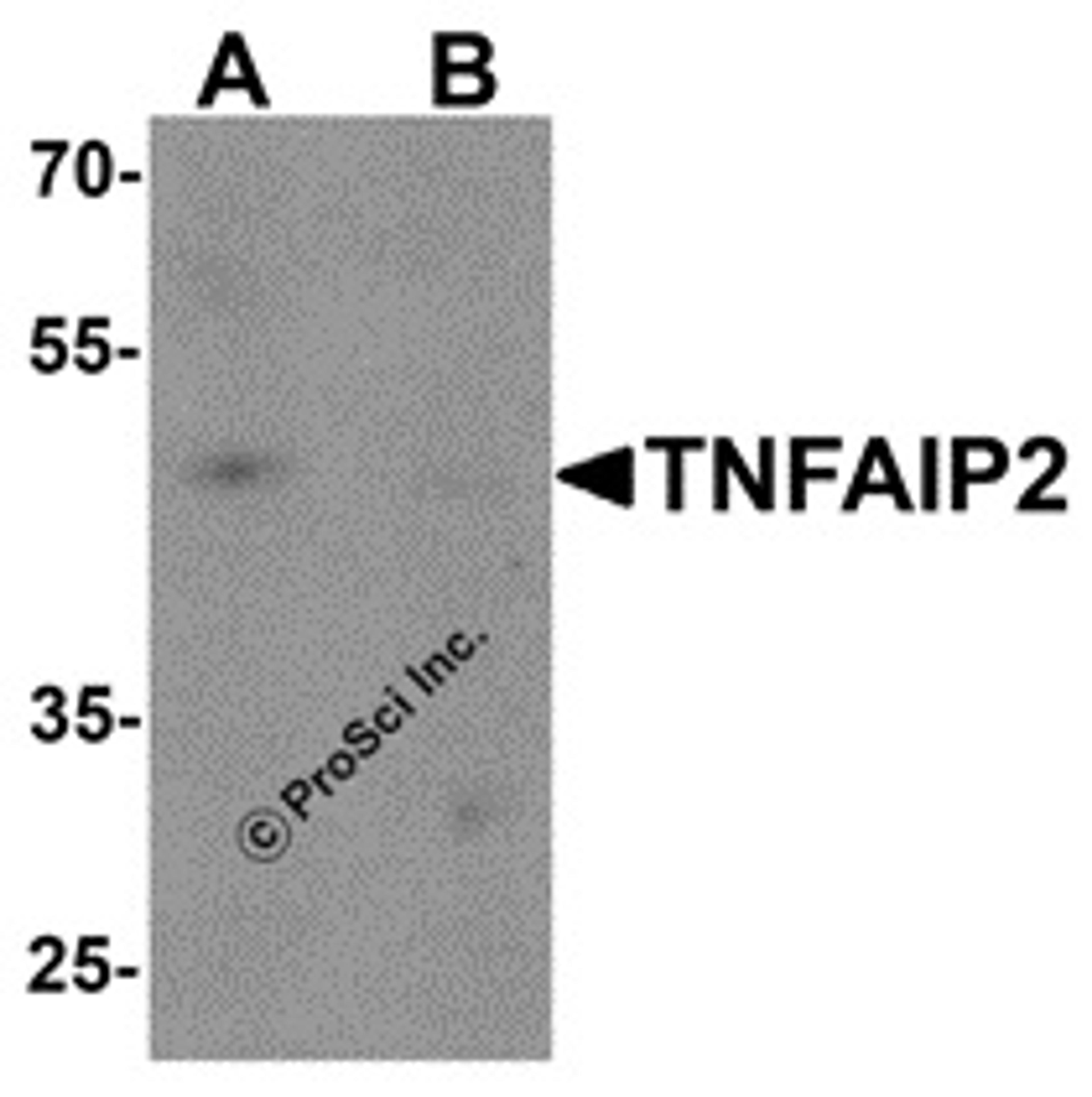 Western blot analysis of TNFAIP2 in K562 cell lysate with TNFAIP2 antibody at 1 μg/mL in (A) the absence and (B) the presence of blocking peptide.