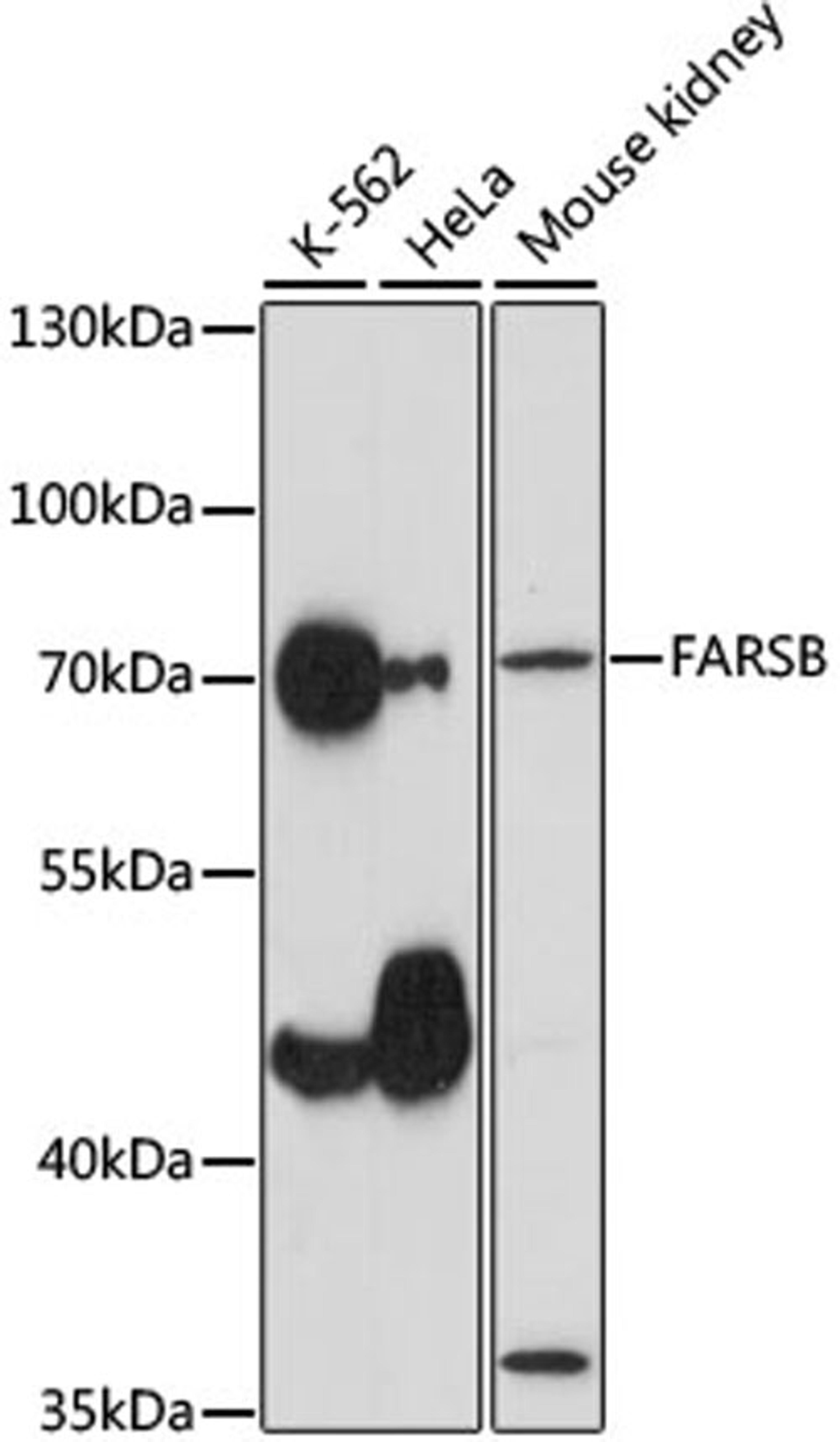 Western blot - FARSB antibody (A15375)