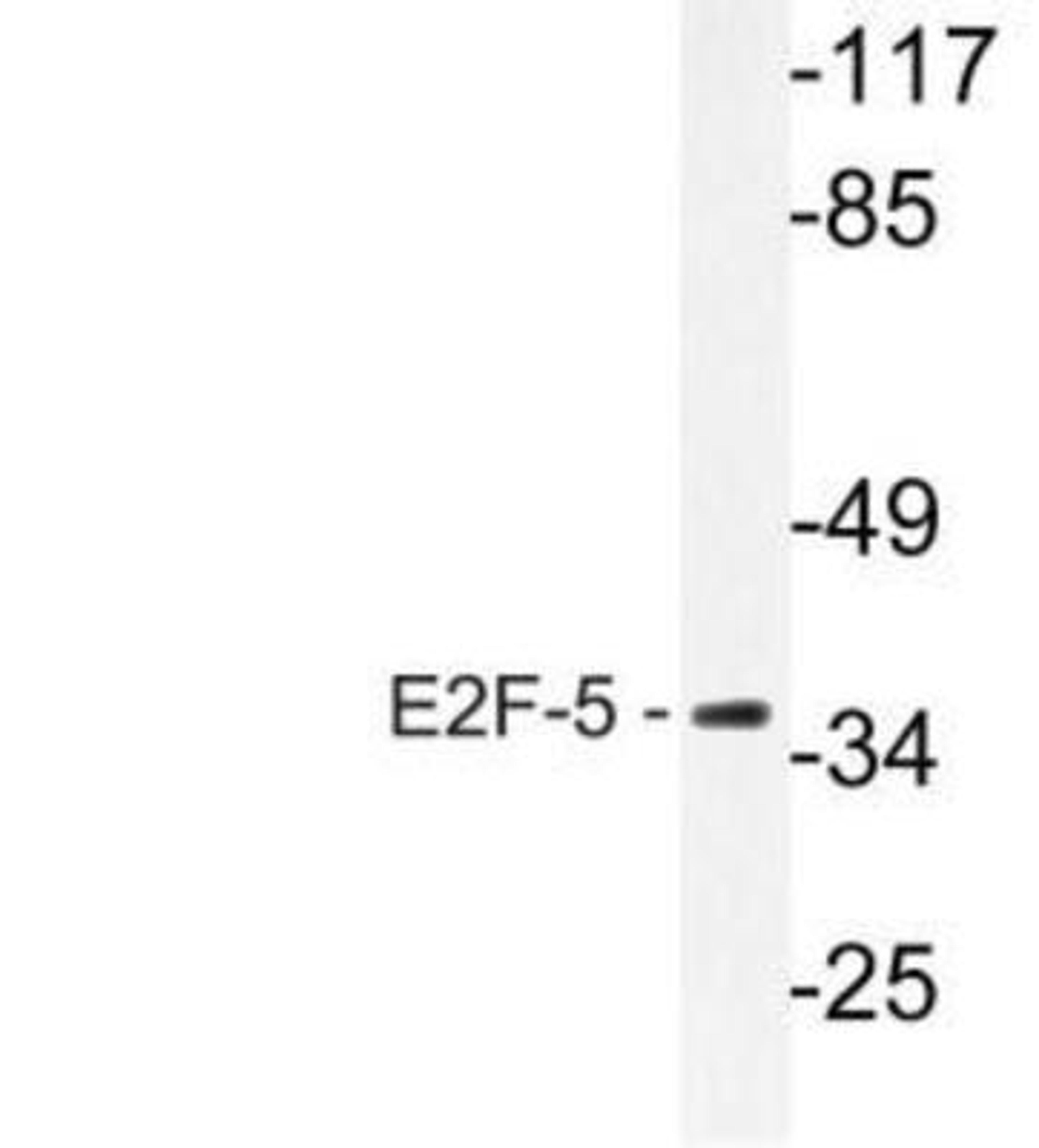 Western Blot: E2F5 Antibody [NBP1-51239] - Analysis of E2F-5 (L142) pAb in extracts from HeLa cells.