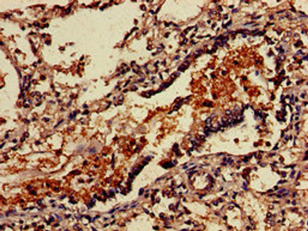 Immunohistochemistry of paraffin-embedded human lung tissue using CSB-PA896869LA01HU at dilution of 1:100