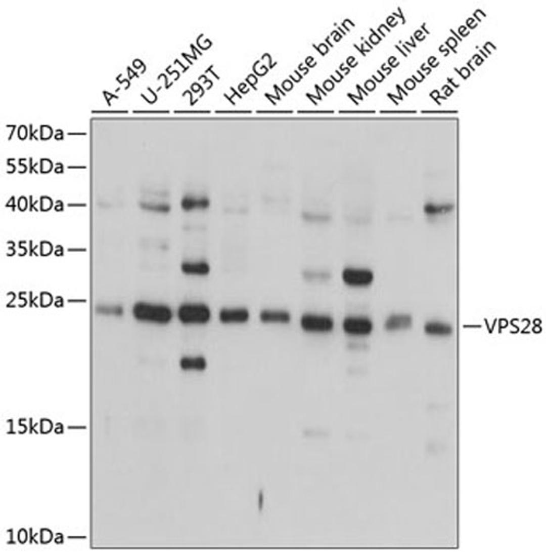 Western blot - VPS28 antibody (A9104)