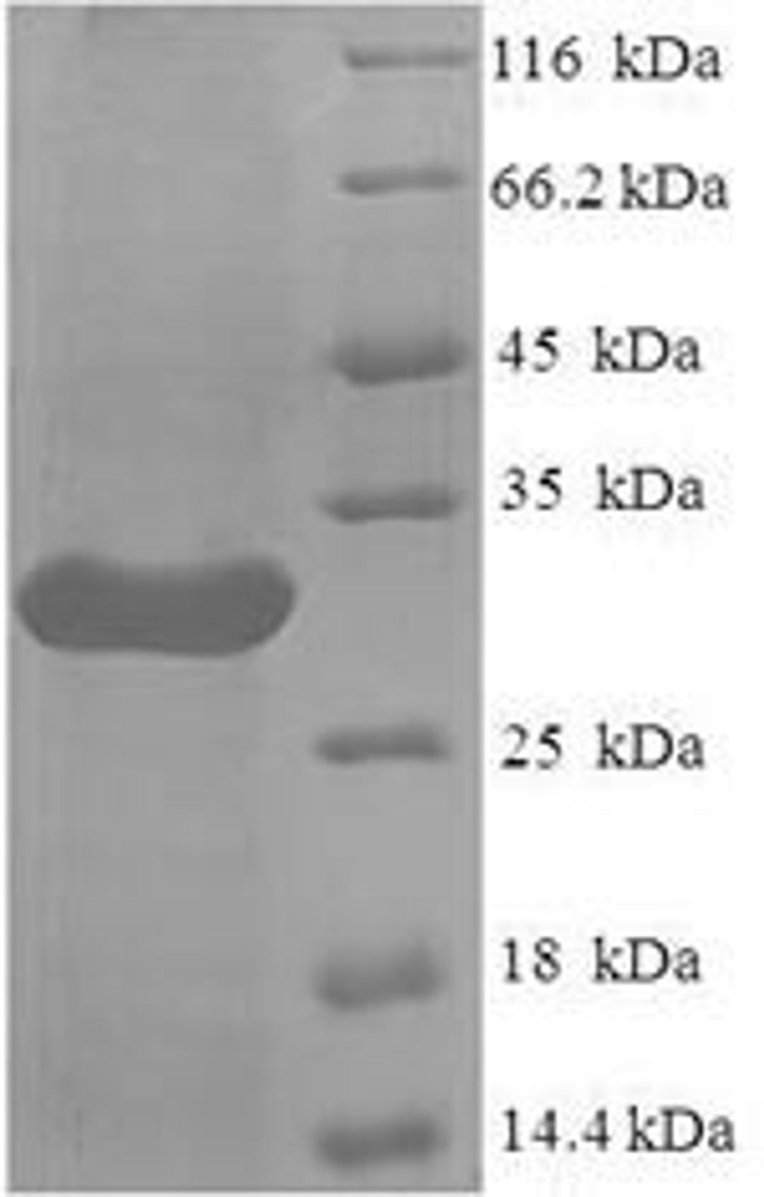 (Tris-Glycine gel) Discontinuous SDS-PAGE (reduced) with 5% enrichment gel and 15% separation gel.