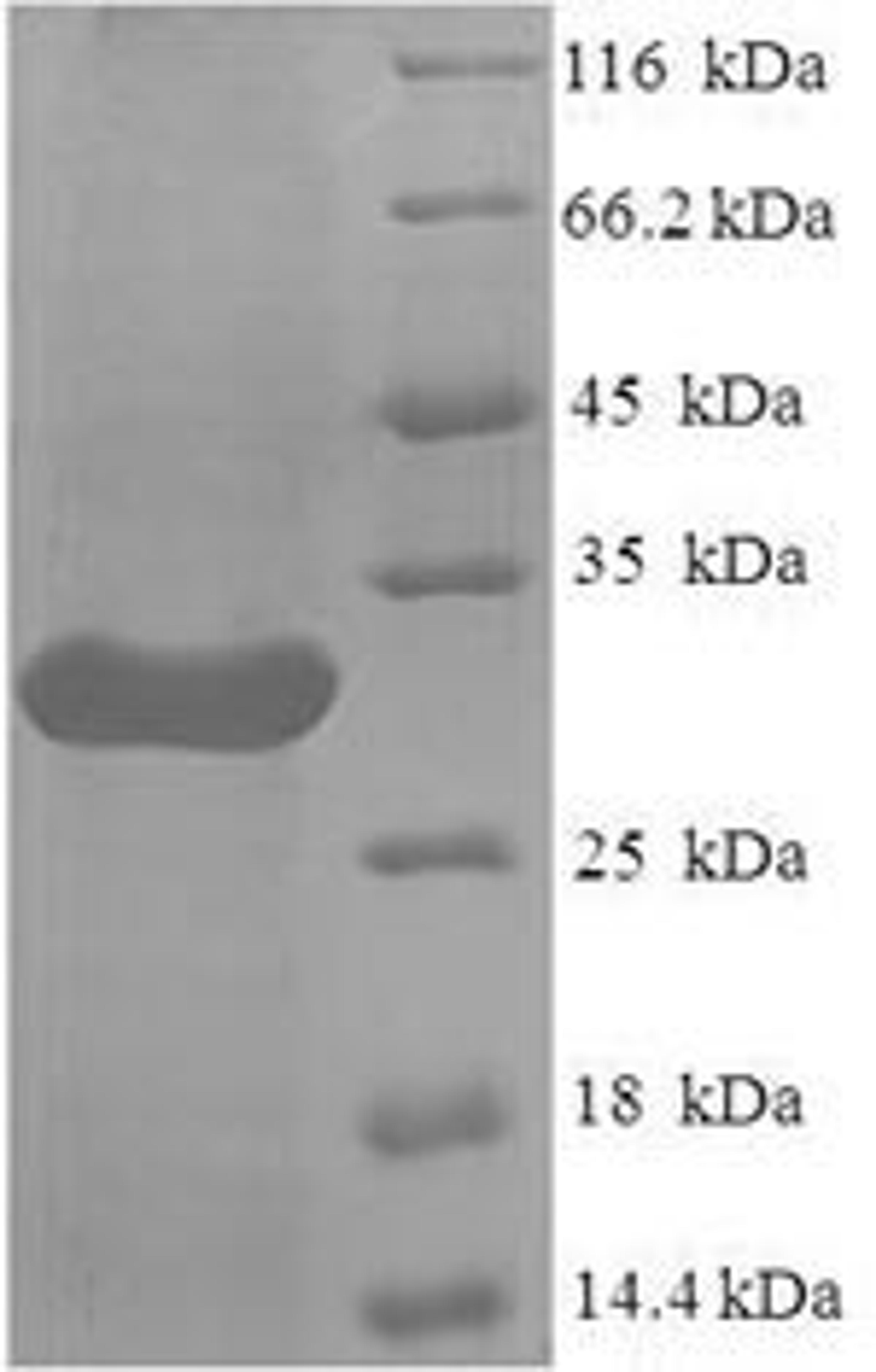 (Tris-Glycine gel) Discontinuous SDS-PAGE (reduced) with 5% enrichment gel and 15% separation gel.