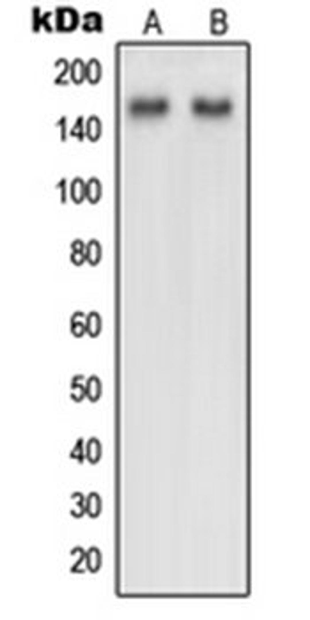 Western blot analysis of HeLa (Lane 1), NIH3T3 (Lane 2) whole cell lysates using NUP160 antibody