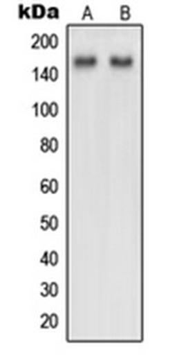 Western blot analysis of HeLa (Lane 1), NIH3T3 (Lane 2) whole cell lysates using NUP160 antibody