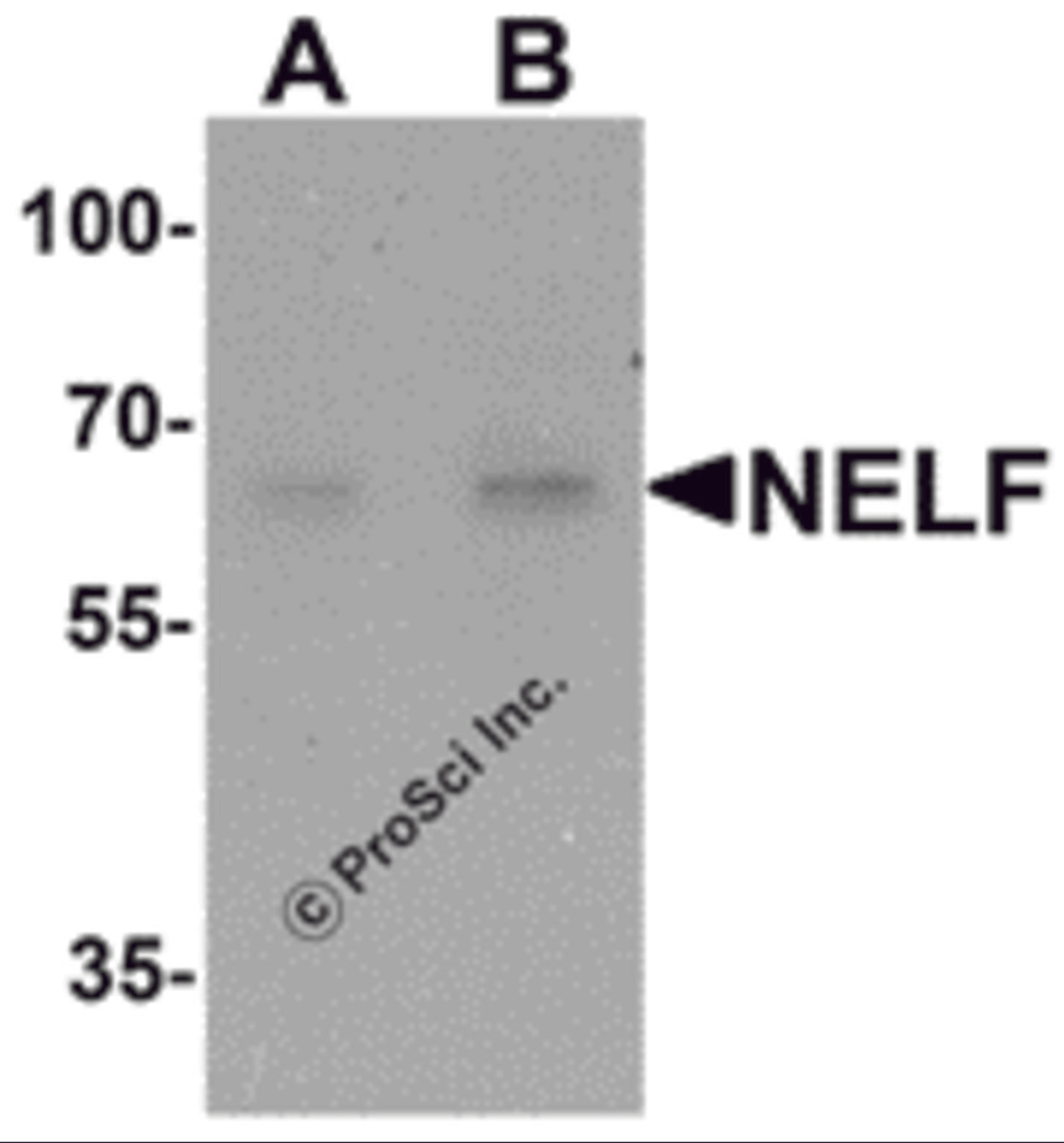 Western blot analysis of NELF in Hela cell lysate with NELF antibody at (A) 1 and (B) 2 μg/mL.