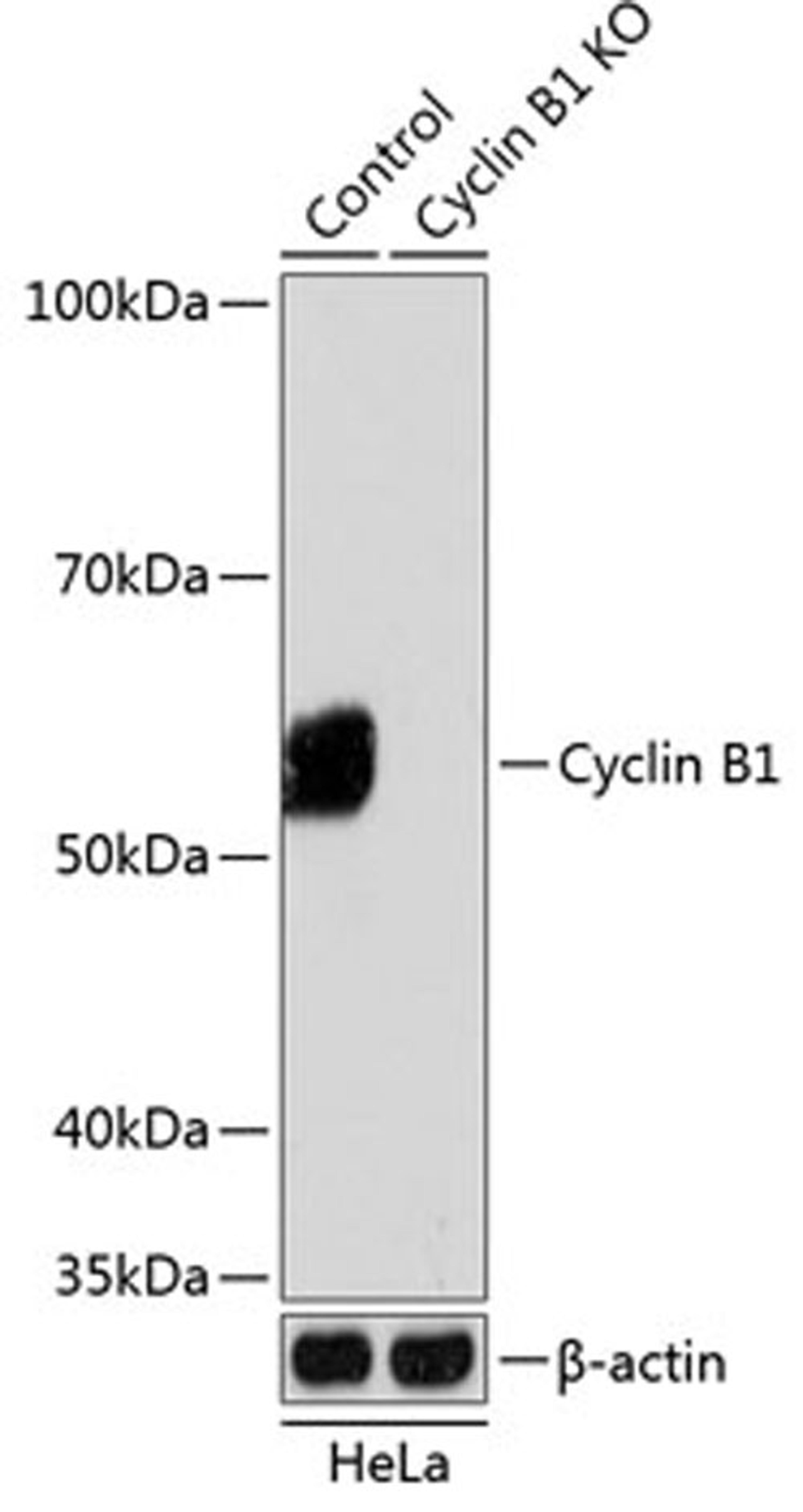 Western blot - Cyclin B1 antibody (A19037)