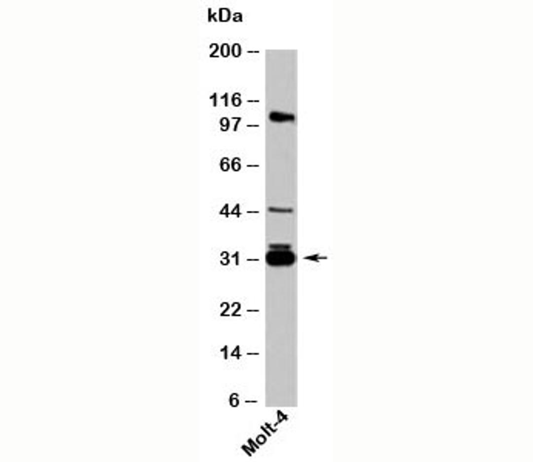 Western blot testing of human samples with 14-3-3 sigma antibody at 1ug/ml.