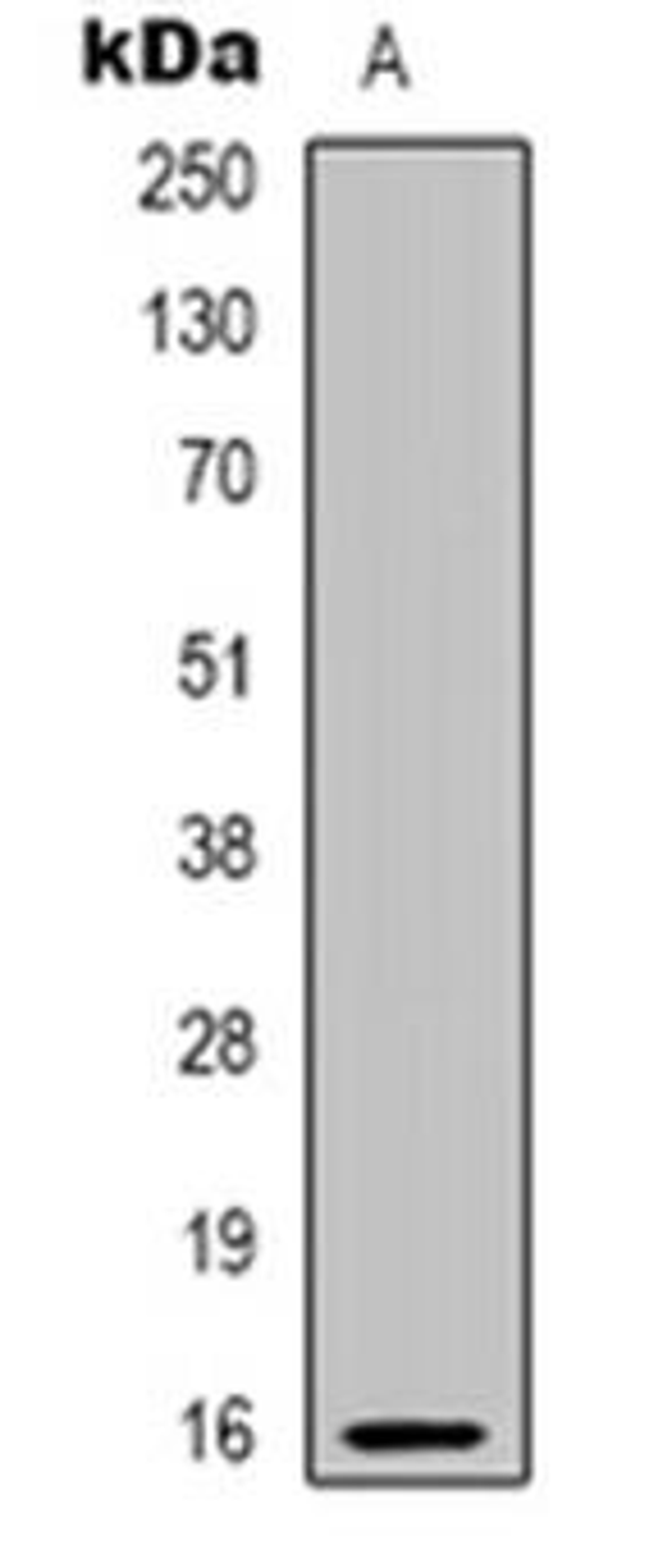 Western blot analysis of PBOV1 expression in human prostate (Lane 1) whole cell lysates using PBOV1 antibody