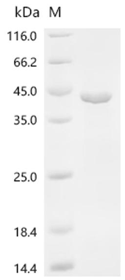 (Tris-Glycine gel) Discontinuous SDS-PAGE (reduced) with 5% enrichment gel and 15% separation gel.