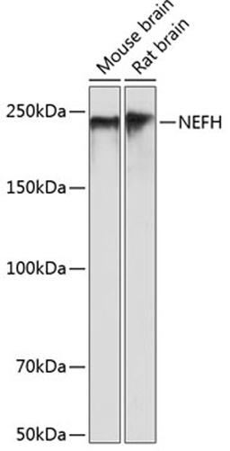 Western blot - NEFH antibody (A19084)