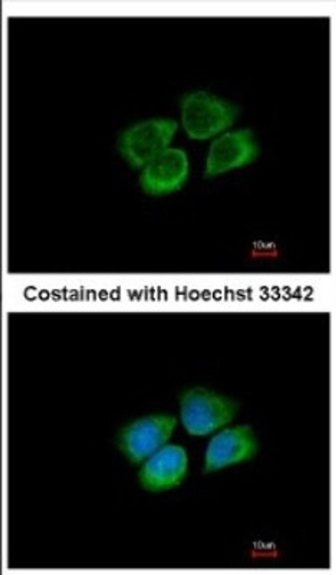 Immunocytochemistry/Immunofluorescence: PARS2 Antibody [NBP2-19702] - Immunofluorescence analysis of methanol-fixed A431, using antibody at 1:500 dilution.