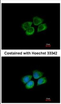 Immunocytochemistry/Immunofluorescence: PARS2 Antibody [NBP2-19702] - Immunofluorescence analysis of methanol-fixed A431, using antibody at 1:500 dilution.