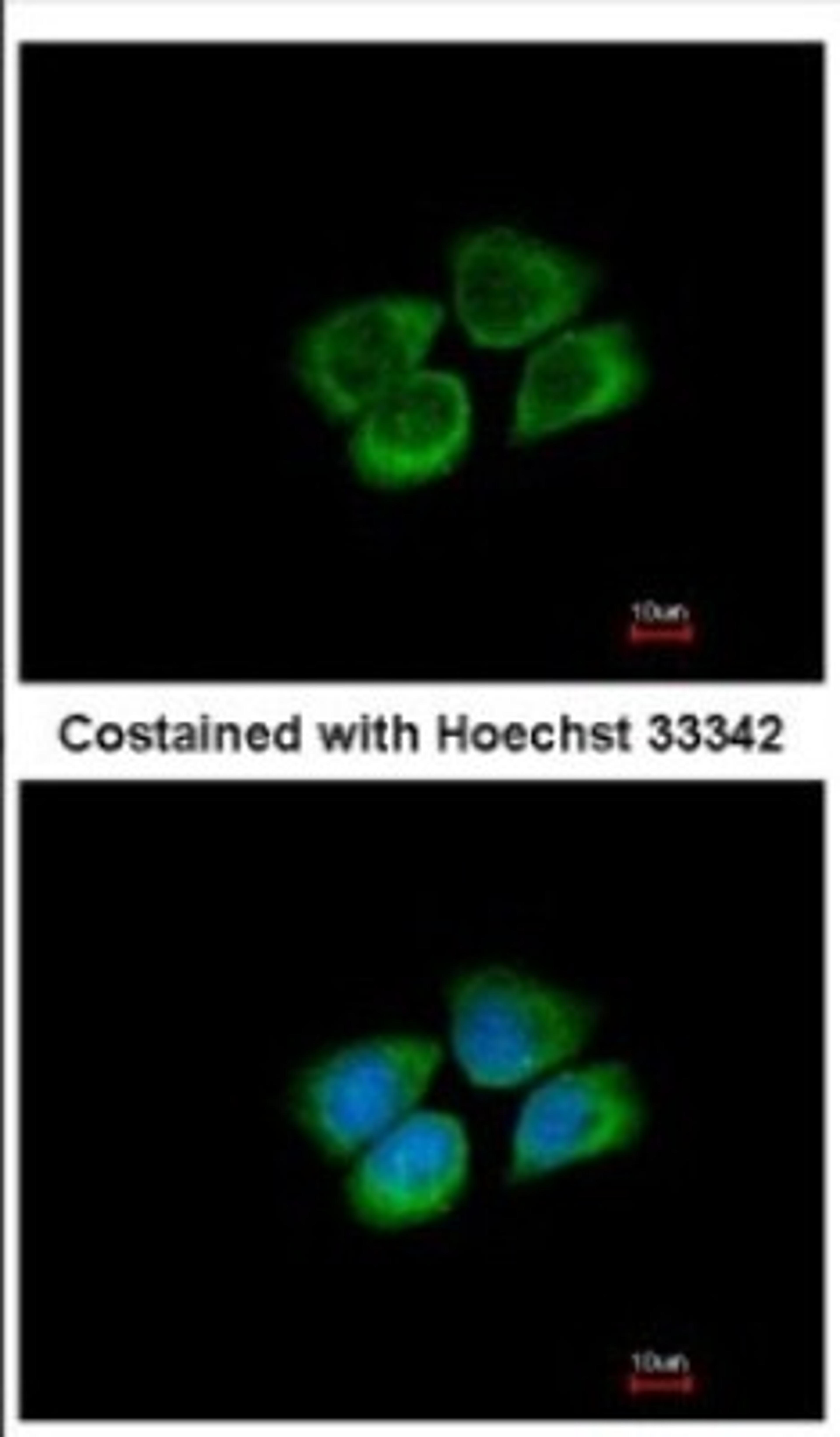 Immunocytochemistry/Immunofluorescence: PARS2 Antibody [NBP2-19702] - Immunofluorescence analysis of methanol-fixed A431, using antibody at 1:500 dilution.