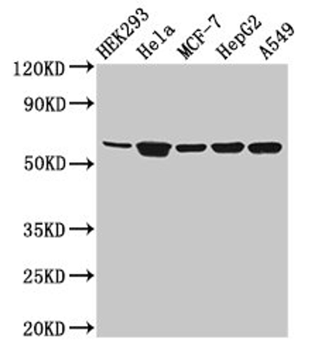 Western Blot. Positive WB detected in: HEK293 whole cell lysate, Hela whole cell lysate, MCF-7 whole cell lysate, HepG2 whole cell lysate, A549 whole cell lysate. All lanes: CYP4F22 antibody at 3.2µg/ml. Secondary. Goat polyclonal to rabbit IgG at 1/50000 dilution. Predicted band size: 62 kDa. Observed band size: 62 kDa