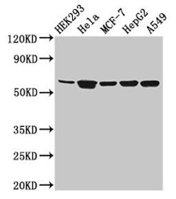 Western Blot. Positive WB detected in: HEK293 whole cell lysate, Hela whole cell lysate, MCF-7 whole cell lysate, HepG2 whole cell lysate, A549 whole cell lysate. All lanes: CYP4F22 antibody at 3.2µg/ml. Secondary. Goat polyclonal to rabbit IgG at 1/50000 dilution. Predicted band size: 62 kDa. Observed band size: 62 kDa