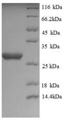 (Tris-Glycine gel) Discontinuous SDS-PAGE (reduced) with 5% enrichment gel and 15% separation gel.
