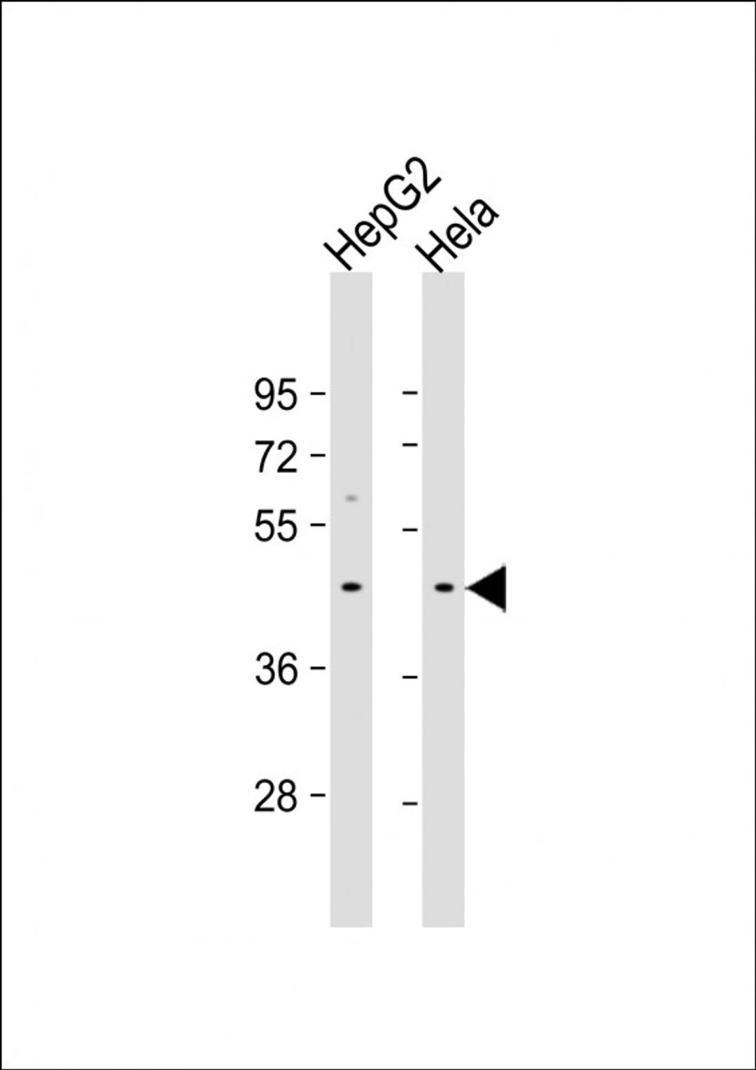 Western Blot at 1:1000 dilution Lane 1: HepG2 whole cell lysate Lane 2: Hela whole cell lysate Lysates/proteins at 20 ug per lane.