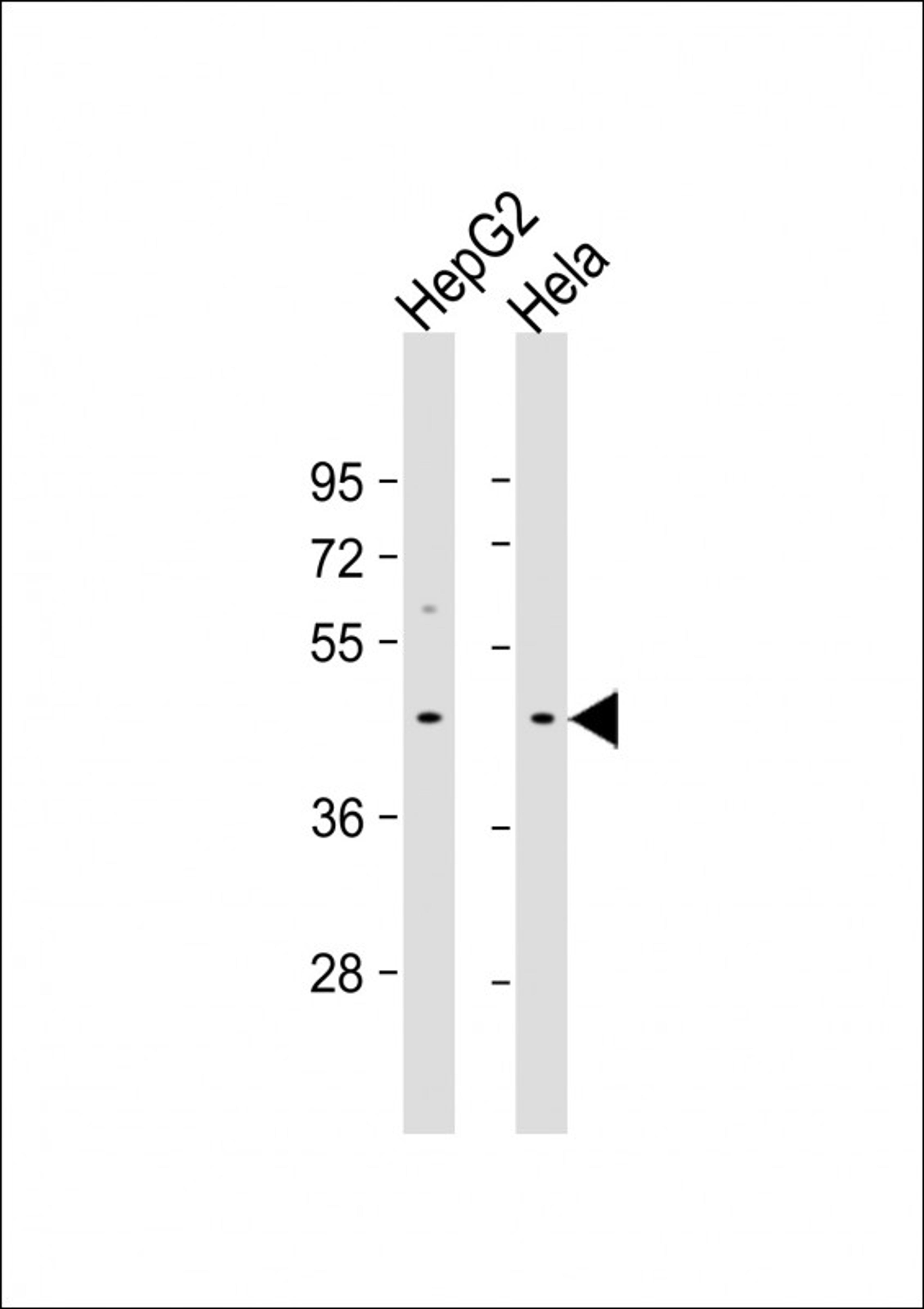 Western Blot at 1:1000 dilution Lane 1: HepG2 whole cell lysate Lane 2: Hela whole cell lysate Lysates/proteins at 20 ug per lane.