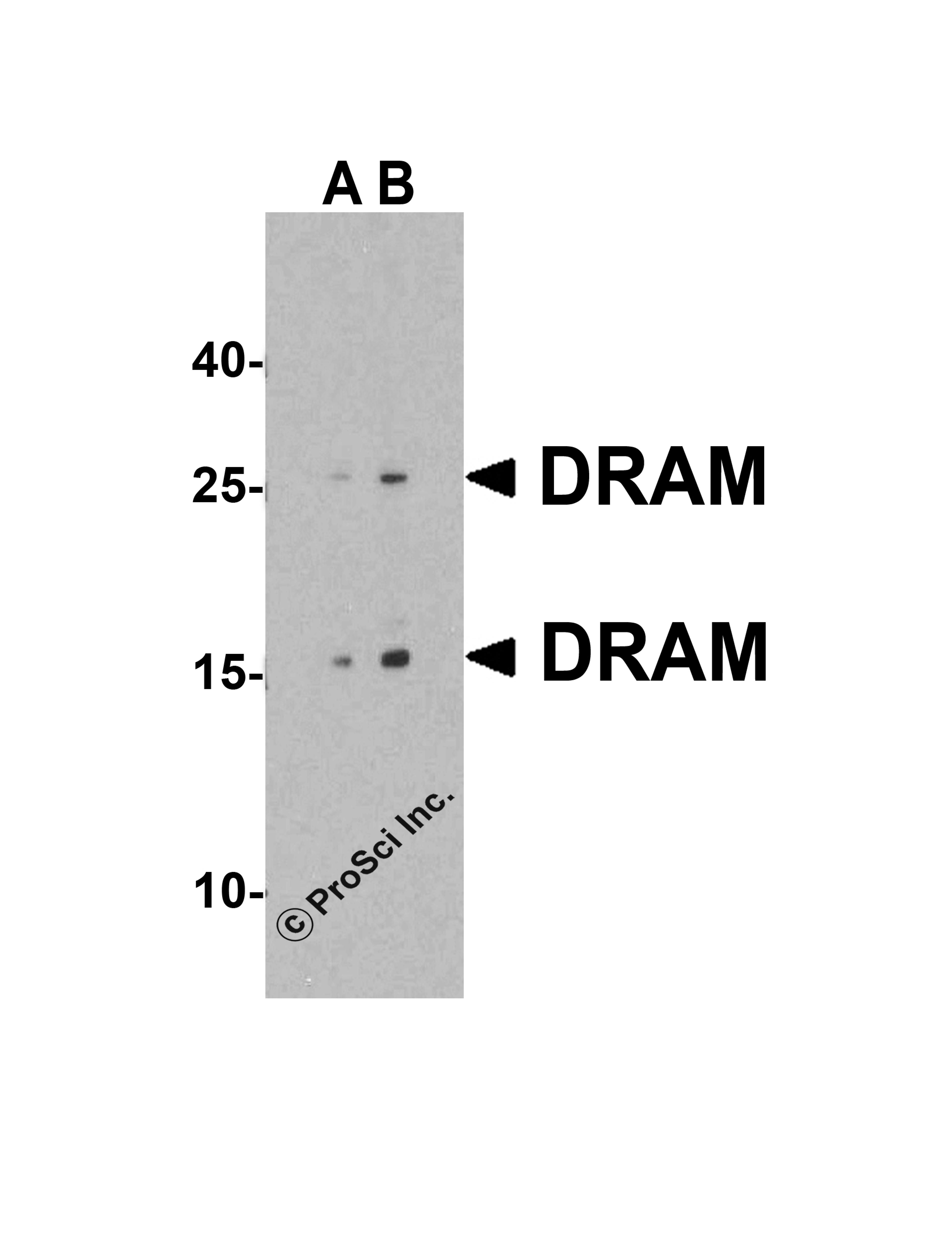 Western blot analysis of DRAM in 293 cell lysate with DRAM antibody at (A) 1 and (B) 2 &#956;g/mL.