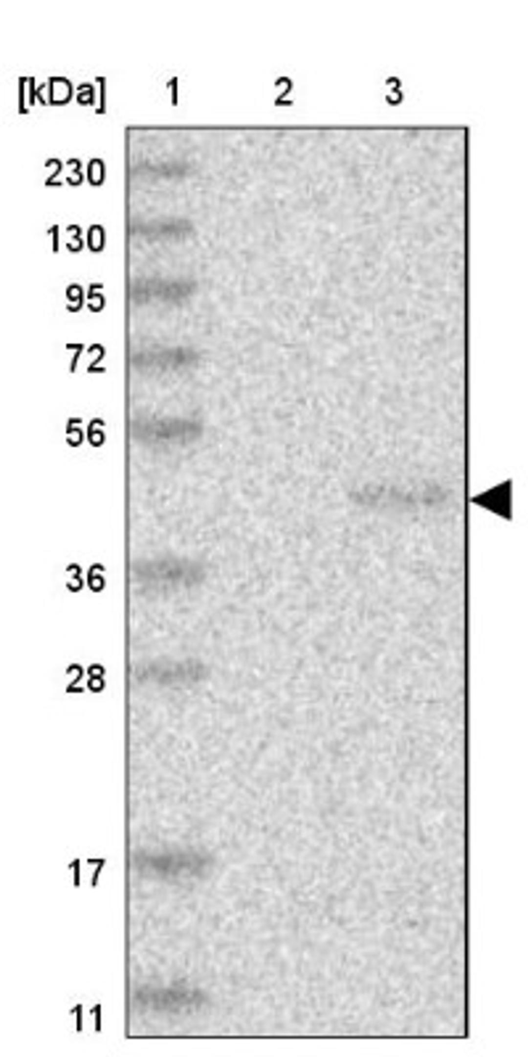 Western Blot: PNRC1 Antibody [NBP1-90837] - Lane 1: Marker [kDa] 230, 130, 95, 72, 56, 36, 28, 17, 11<br/>Lane 2: Human cell line RT-4<br/>Lane 3: Human cell line U-251MG sp