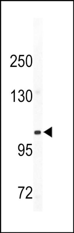 Western blot analysis of CD49e antibody in mouse bladder tissue lysates (35ug/lane)